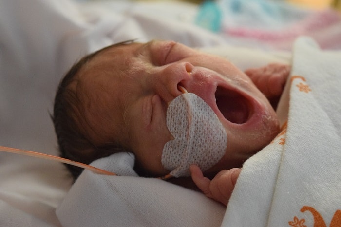 baby Petra is held by her parents after her premature birth 05