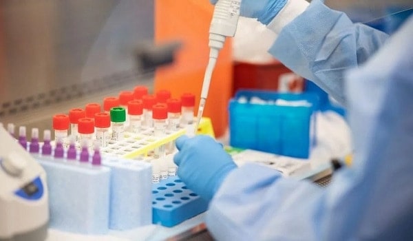 cdc covid 19 test lab 01